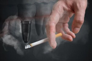sigara ve implant